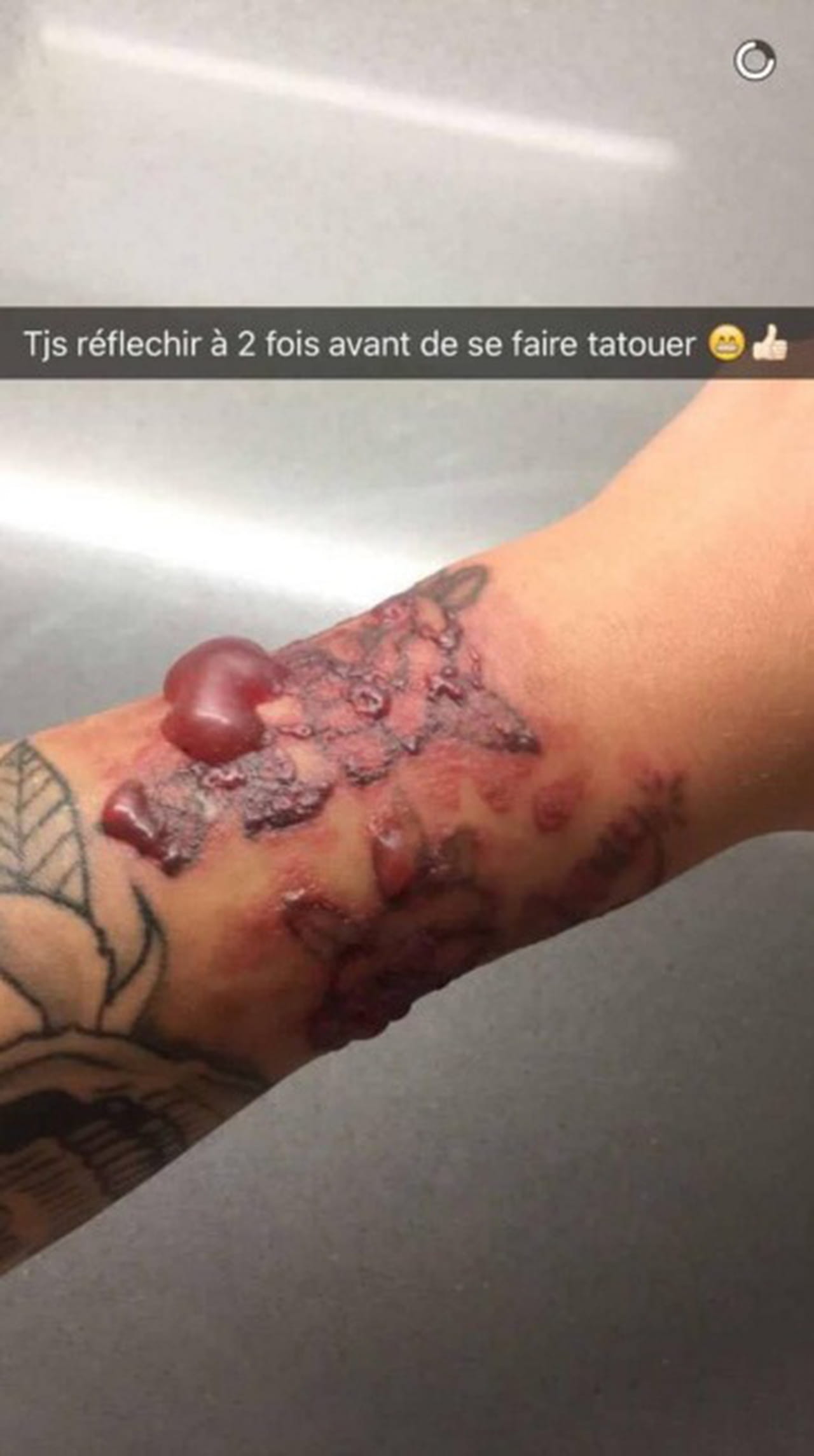 Le traitement aux dorsalgies et les reins