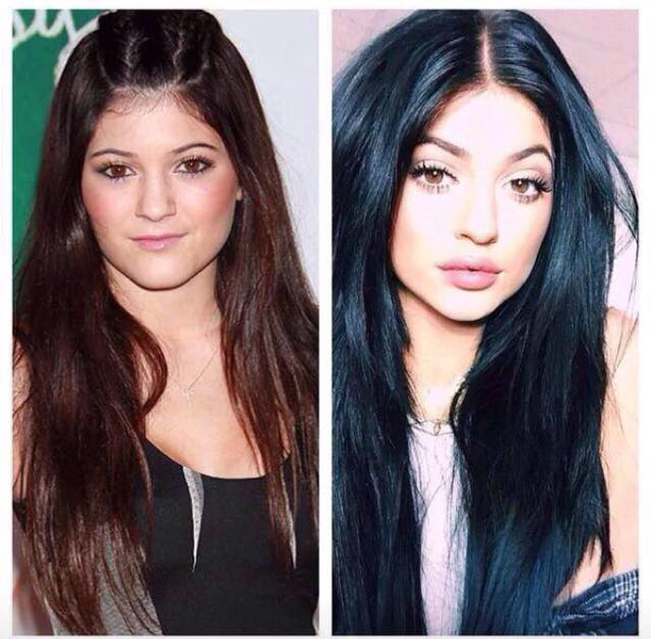 Kylie Jenner, Nabilla... le top des avants/après