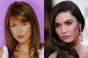 فنانات عالميات قبل وبعد عمليات التجميل!